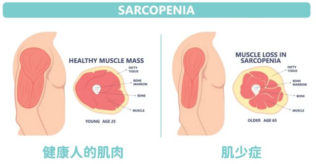 比跑步好坚持比游泳省事！这运动超适合35+妈妈燃脂塑形增肌(图5)